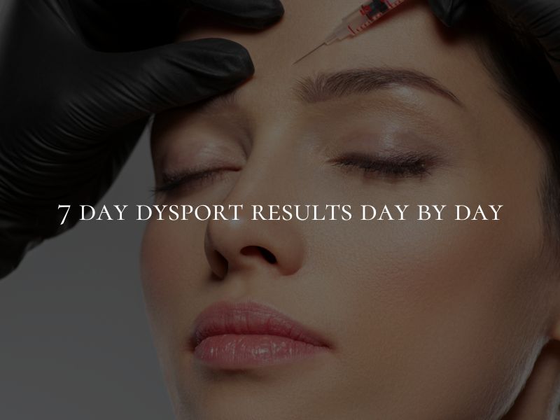 7 day dysport results day by day