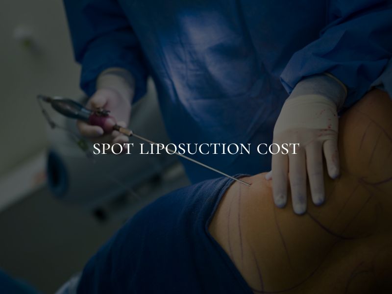 spot liposuction cost