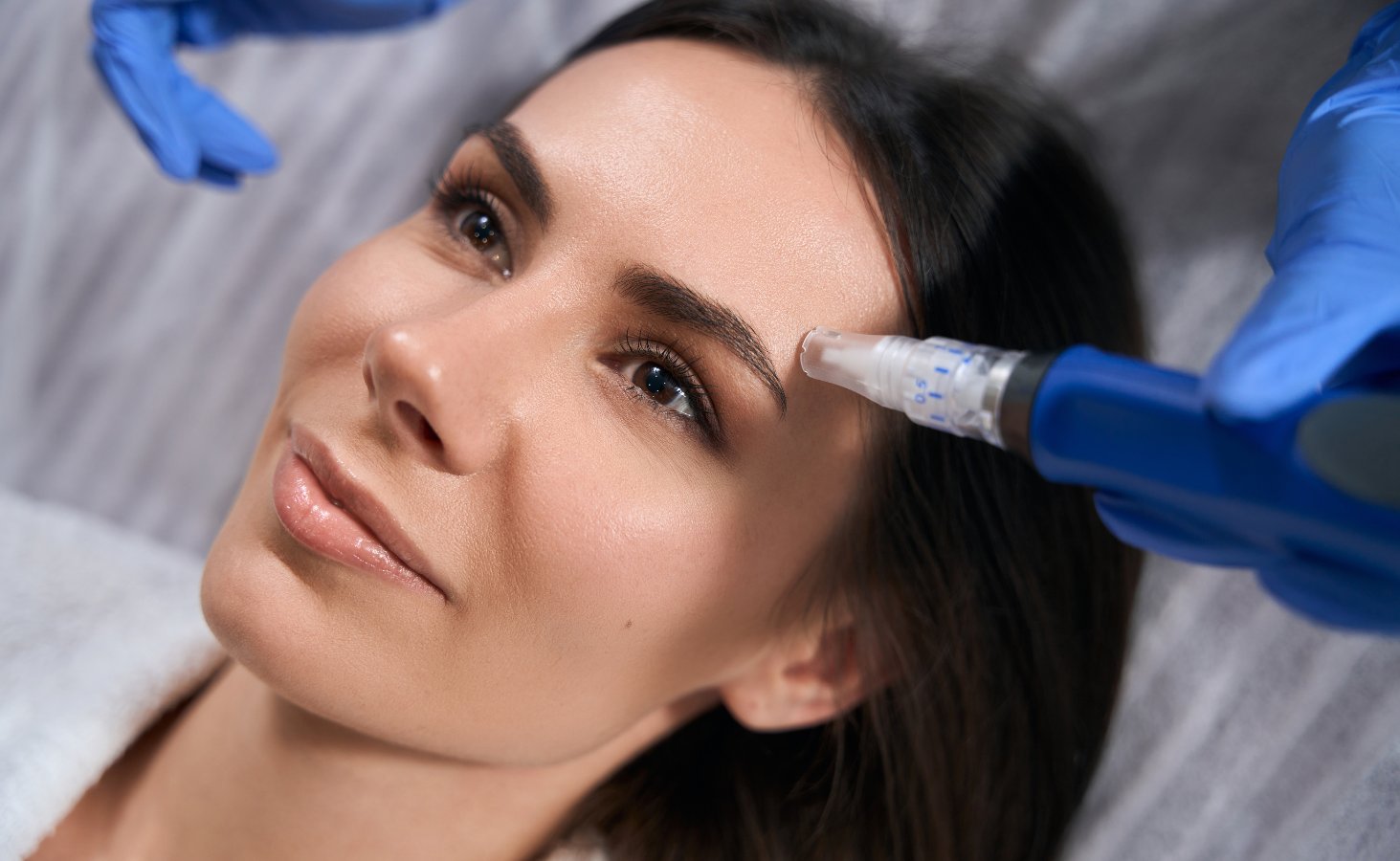 The PiXel8-RF Radio Microneedling System Raleigh