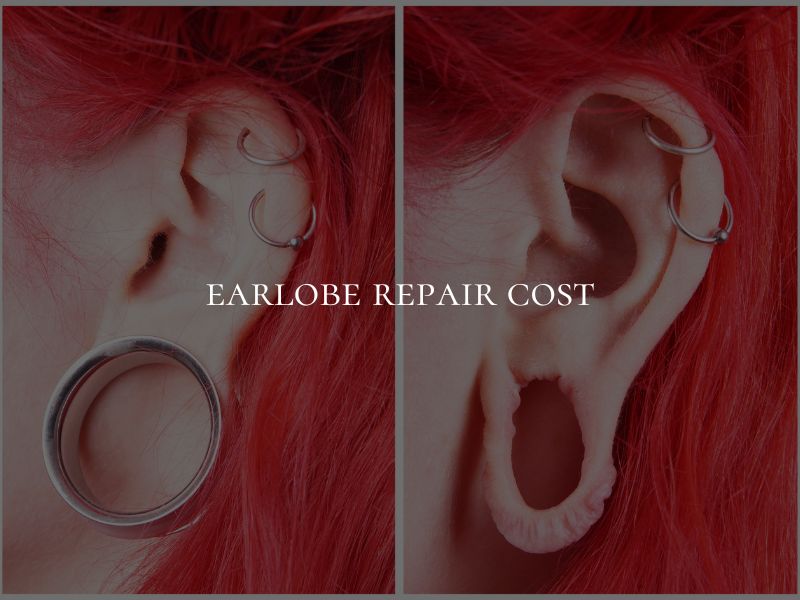 earlobe repair cost