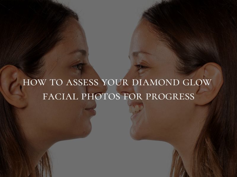 how to assess your diamond glow facial before and after photos