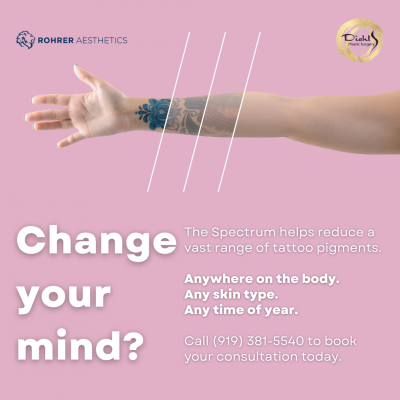 Raleigh Tattoo and Scar Removal